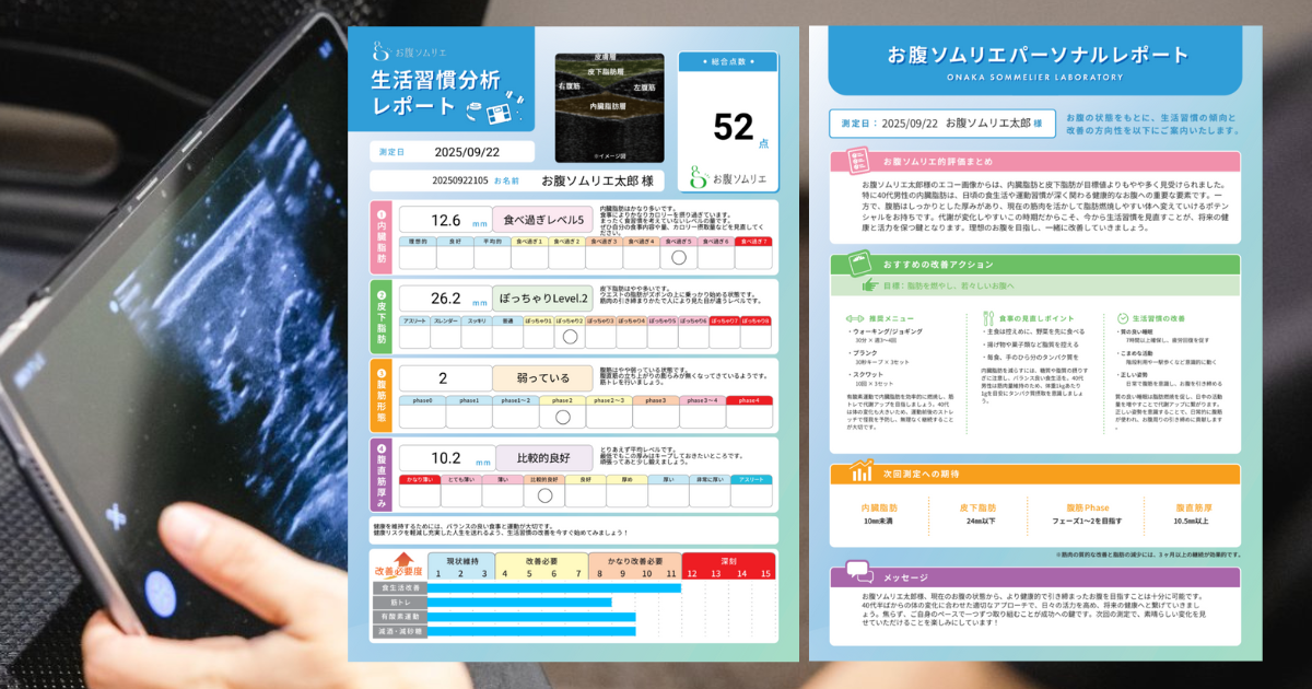 データ解析サポート